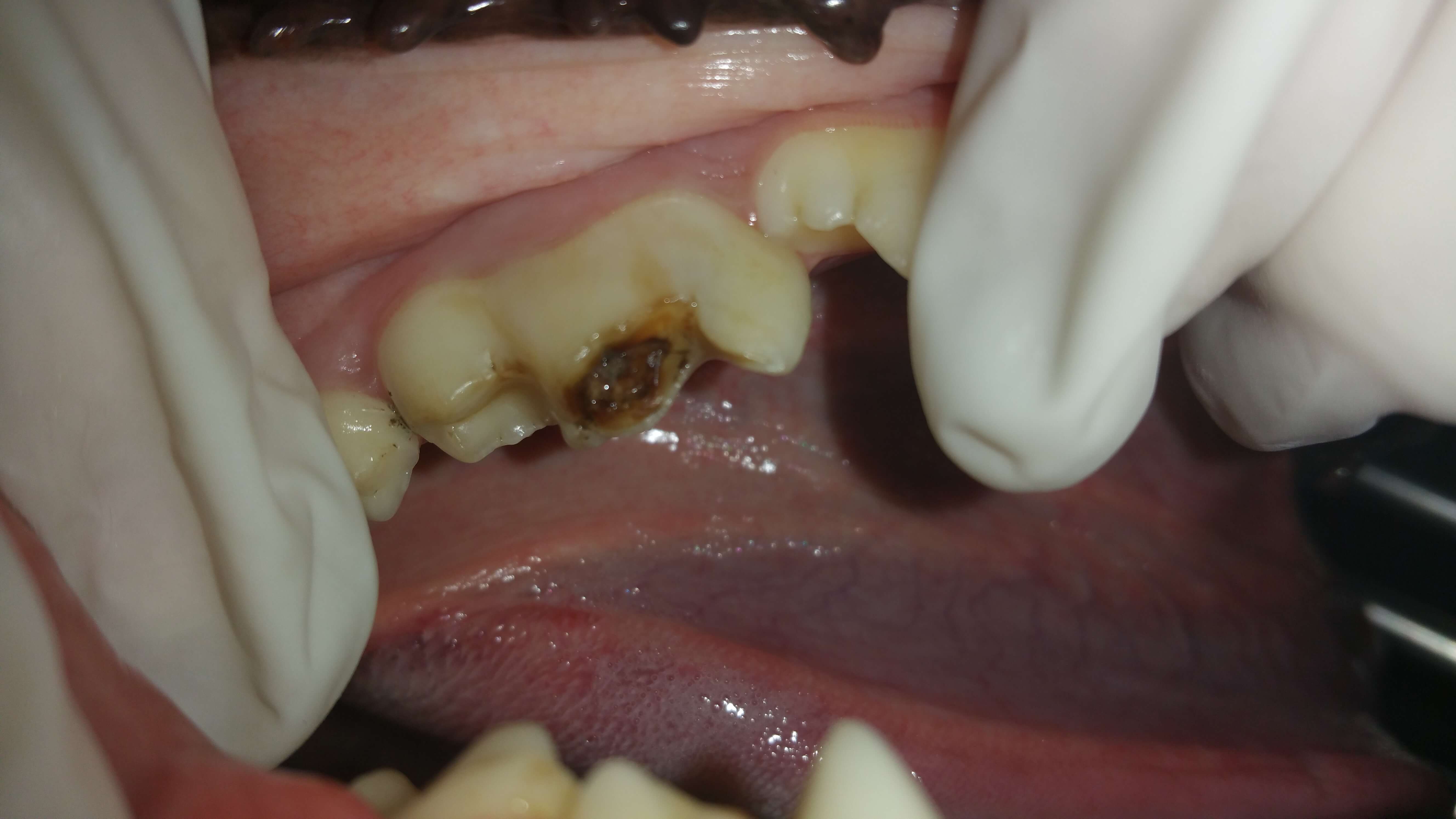 Filling a cavity in dogs tooth by a dog dentist